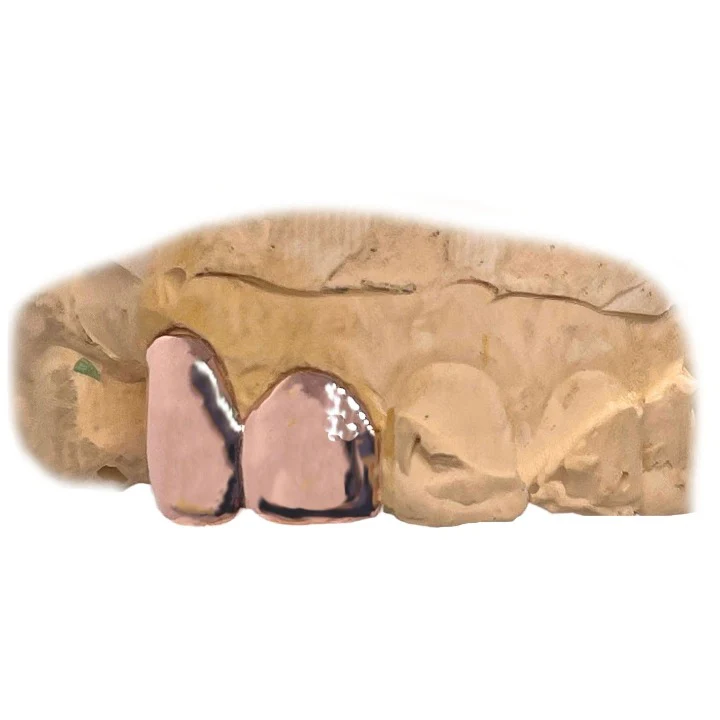 Polished Grillz Top 2pc - Image 3