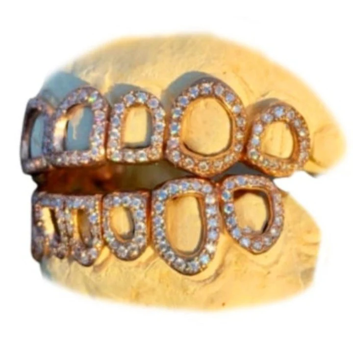 Diamond Open Face Grillz Set - Image 3
