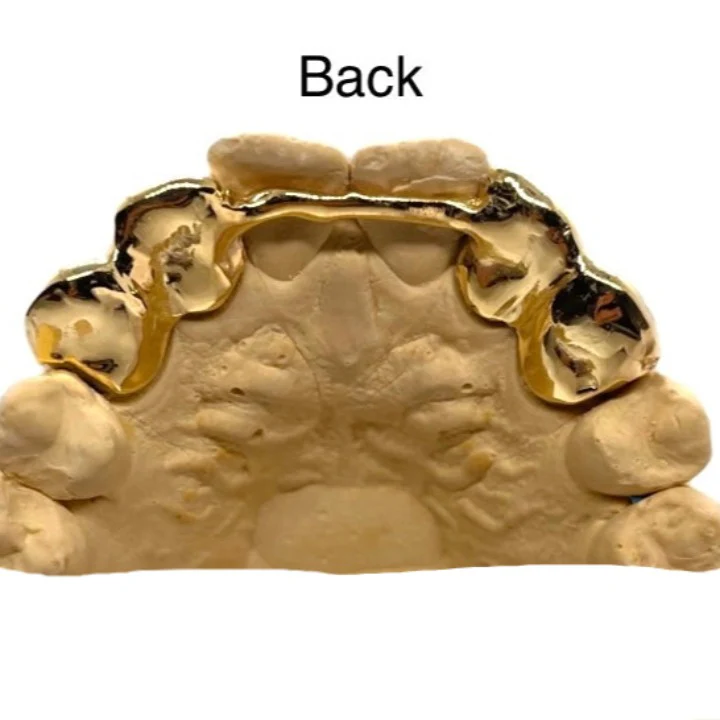 Fangs with Tips & Back Bar Custom Grillz Top or Bottom - Image 4