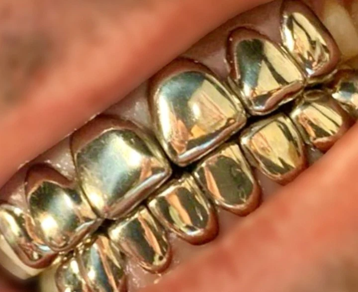 Florida Style Perm Cut Grillz Top or Bottom - Image 6