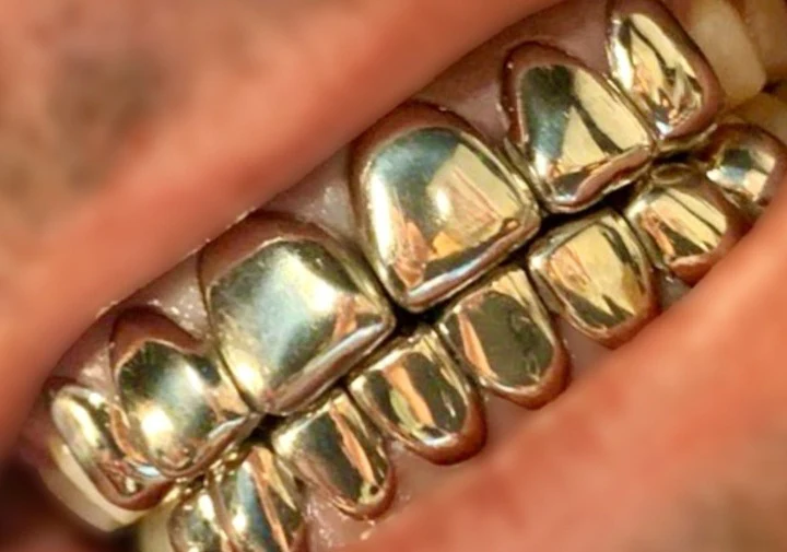 Florida Style Perm Cut Grillz Set - Image 7